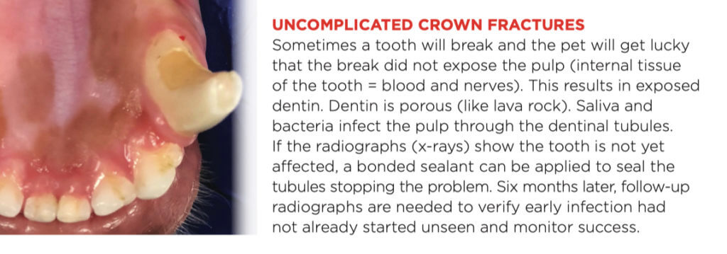 Crown Fractures