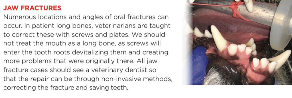 jaw_fractures_1
