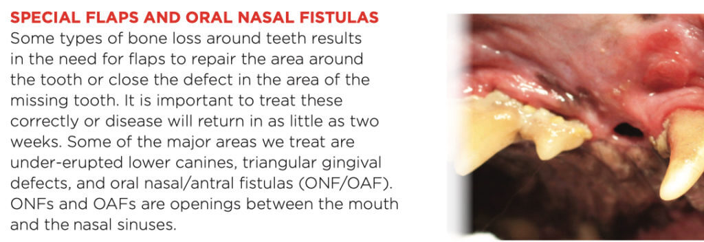 oral nasul fistulas