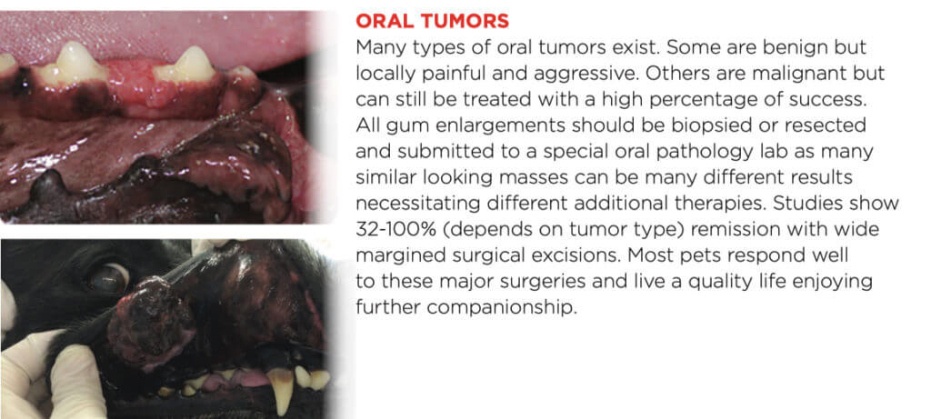 oral tumors