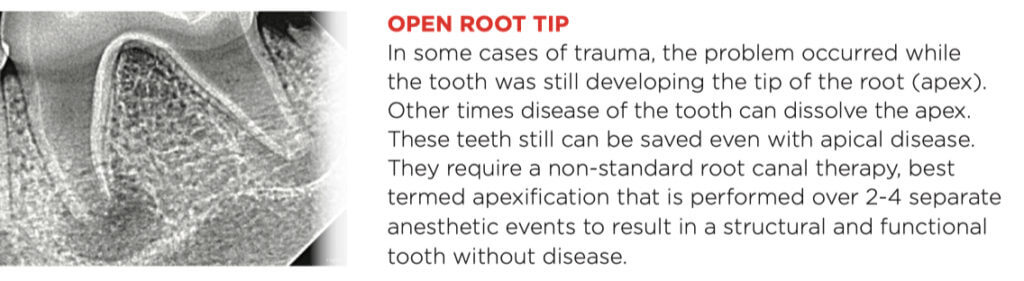 open_root_tip