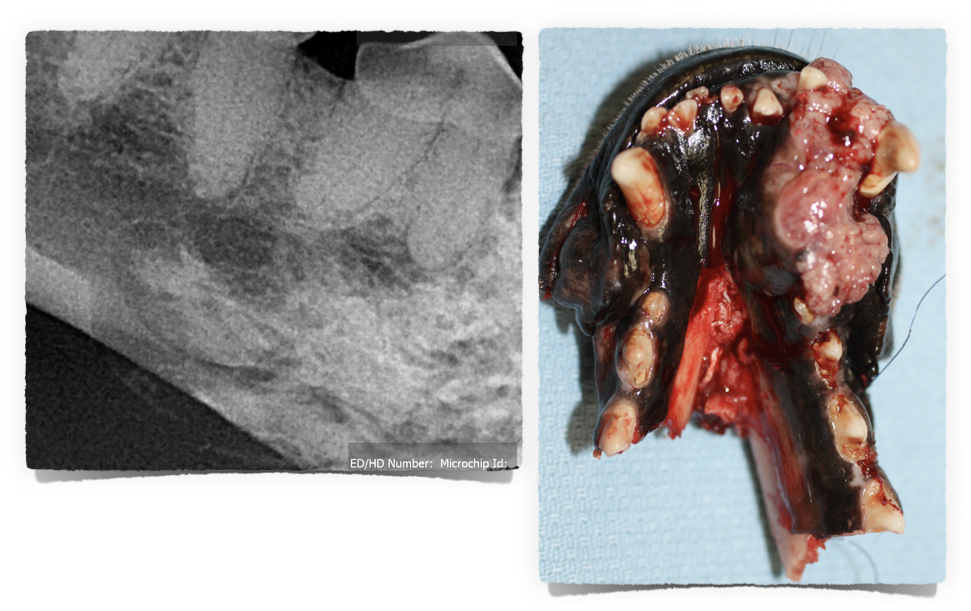 oral tumors