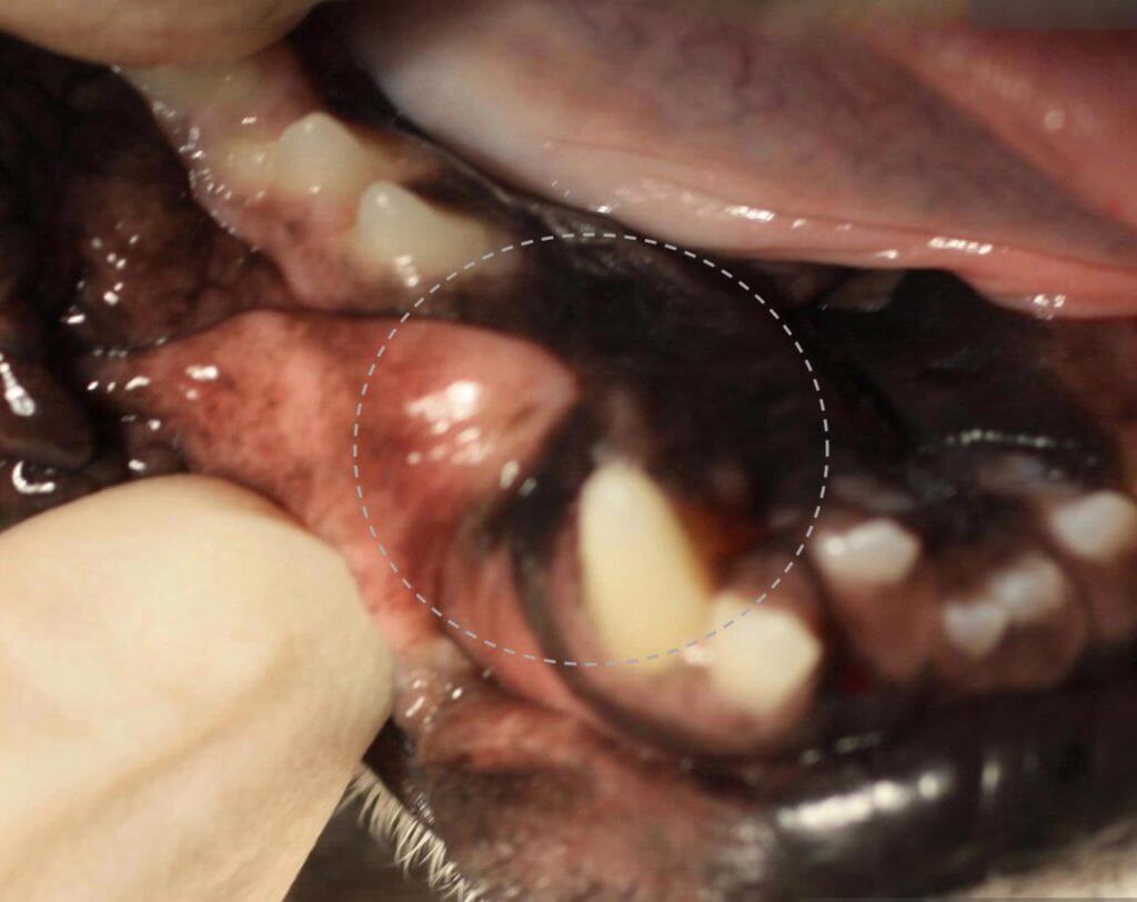 dentigerus cysts