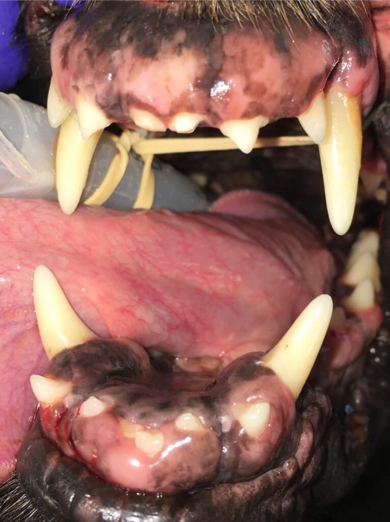 gingival hyperplasia