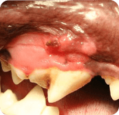 oral tumors