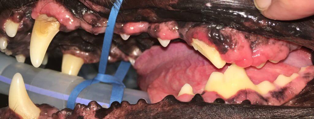 gingival hyperplasia