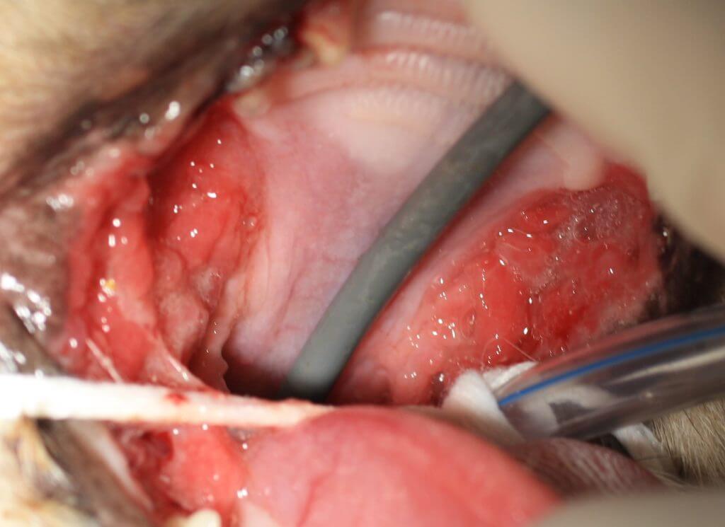 TOOTH_RESORPTION_6