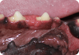 oral tumors