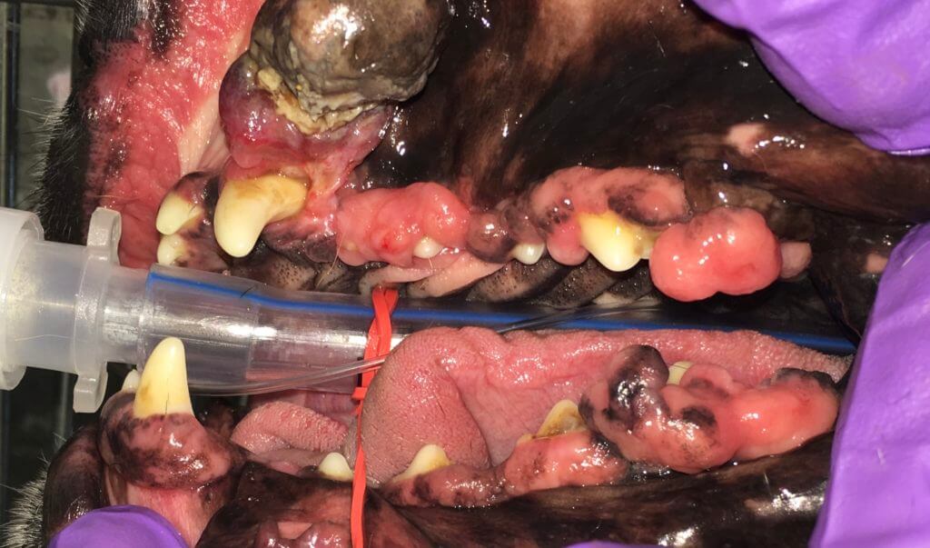 gingival hyperplasia