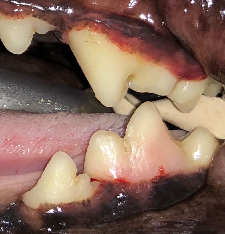 TOOTH_RESORPTION_7