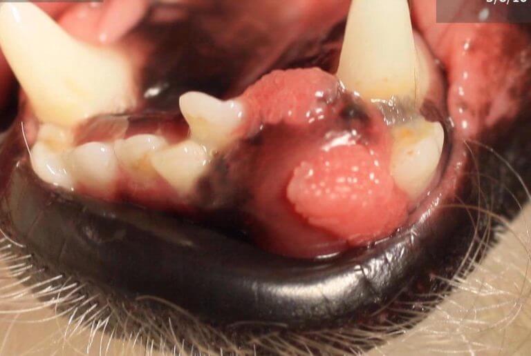 oral tumors