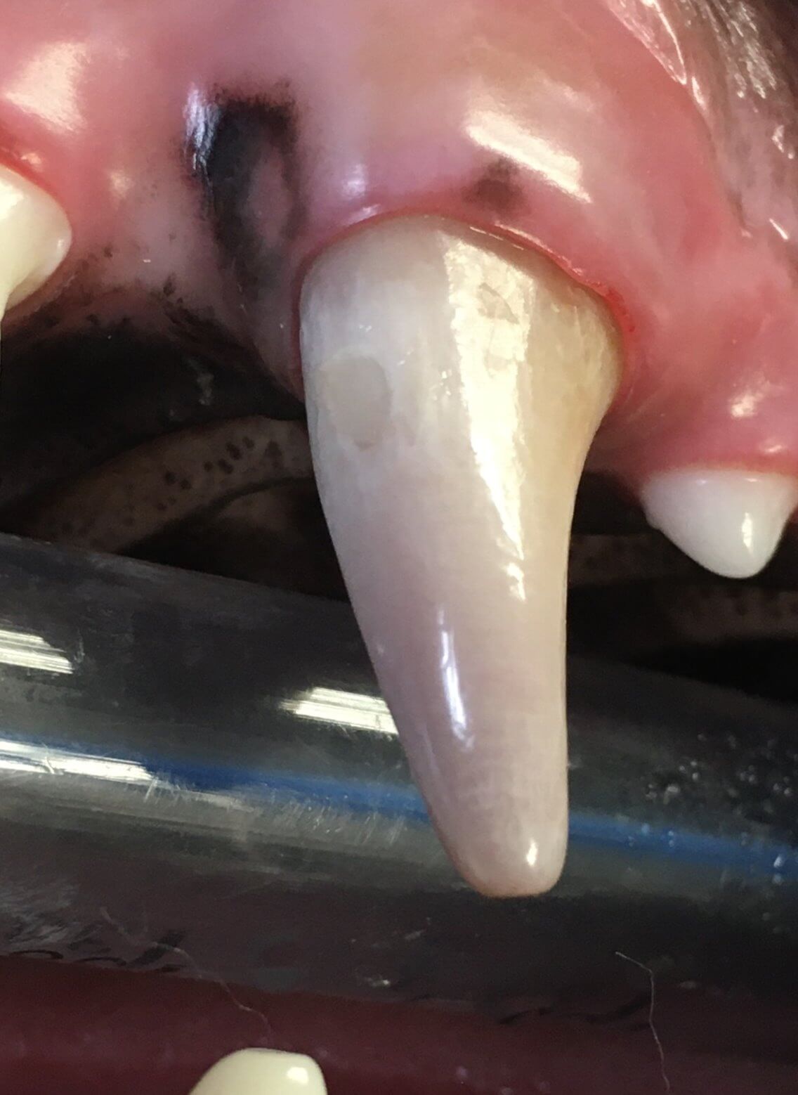  Picture of different Patient's tooth after RCT