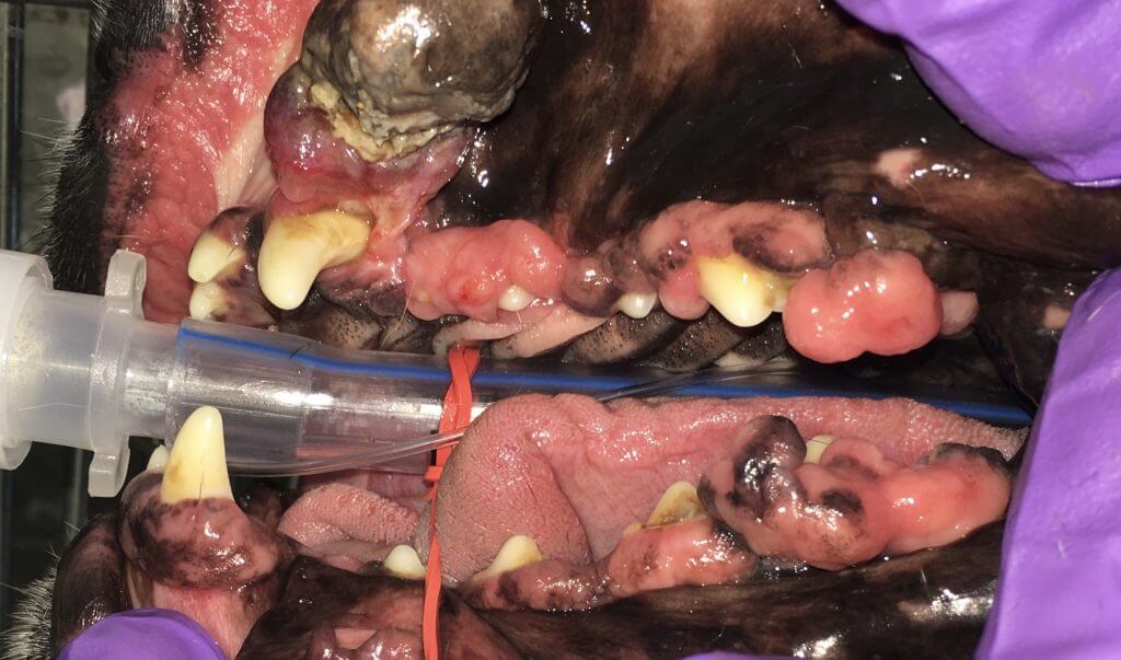 GINIGIVAL HYPERPLASIA