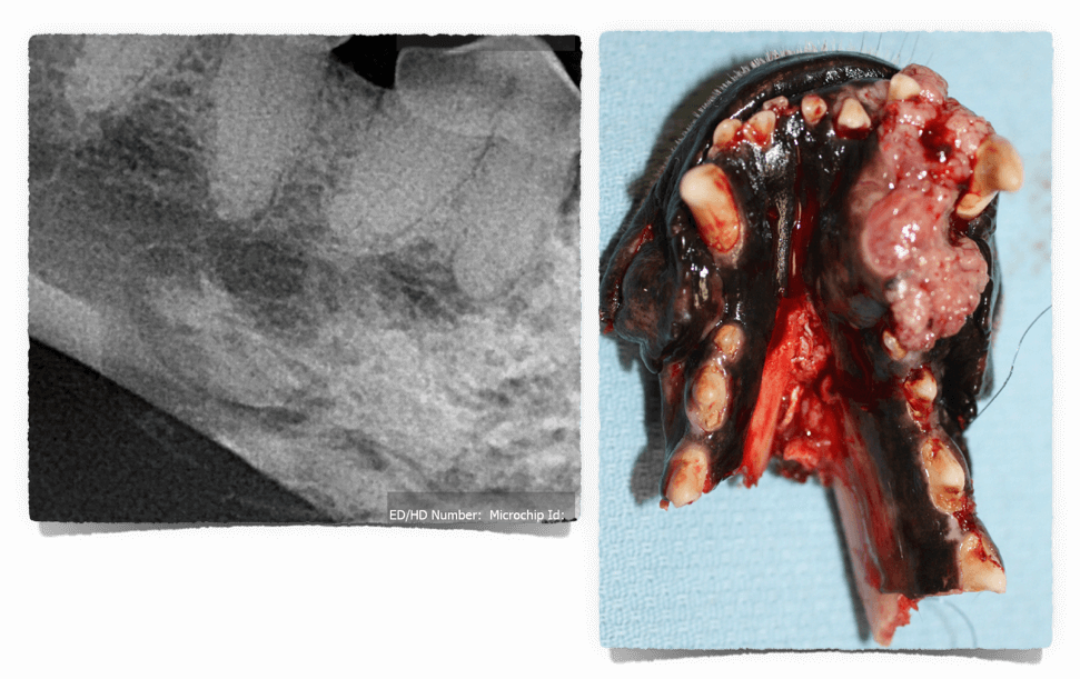 ORAL TUMORS