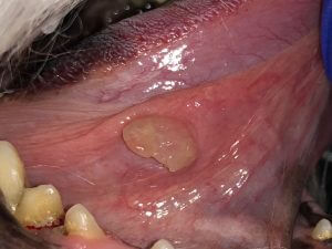 ORAL TUMORS