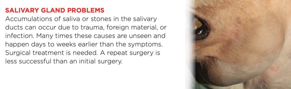 SALIVARY GLAND ISSUES