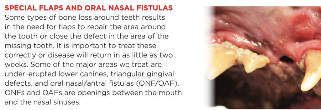 SPECIAL FLAPS AND ORAL NASAL FISTULAS