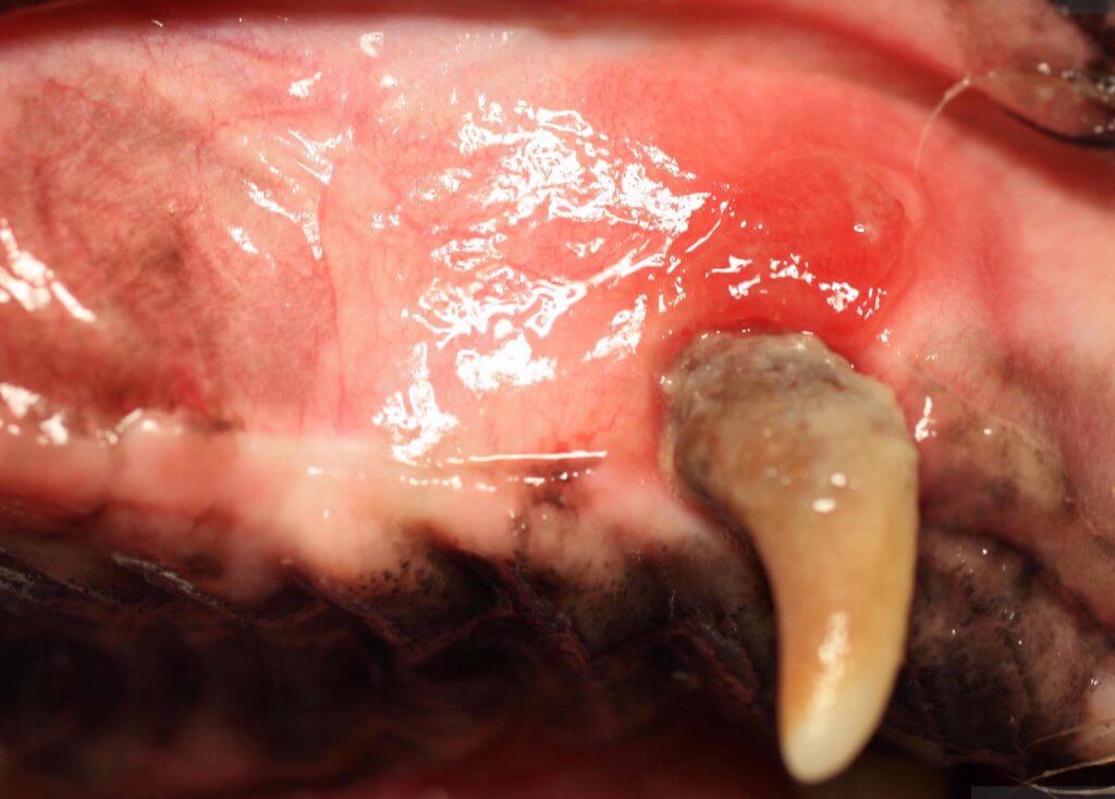 SPECIAL FLAPS AND ORAL NASAL FISTULAS