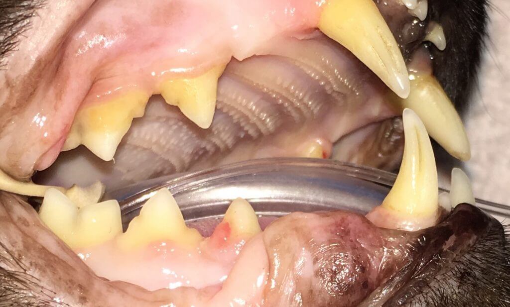 TOOTH RESORPTION