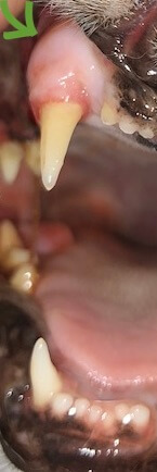 TOOTH RESORPTION