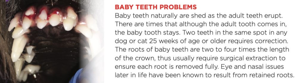 BABY TEETH