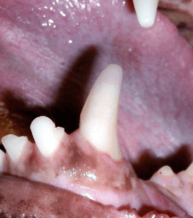 DISCOLORED TEETH