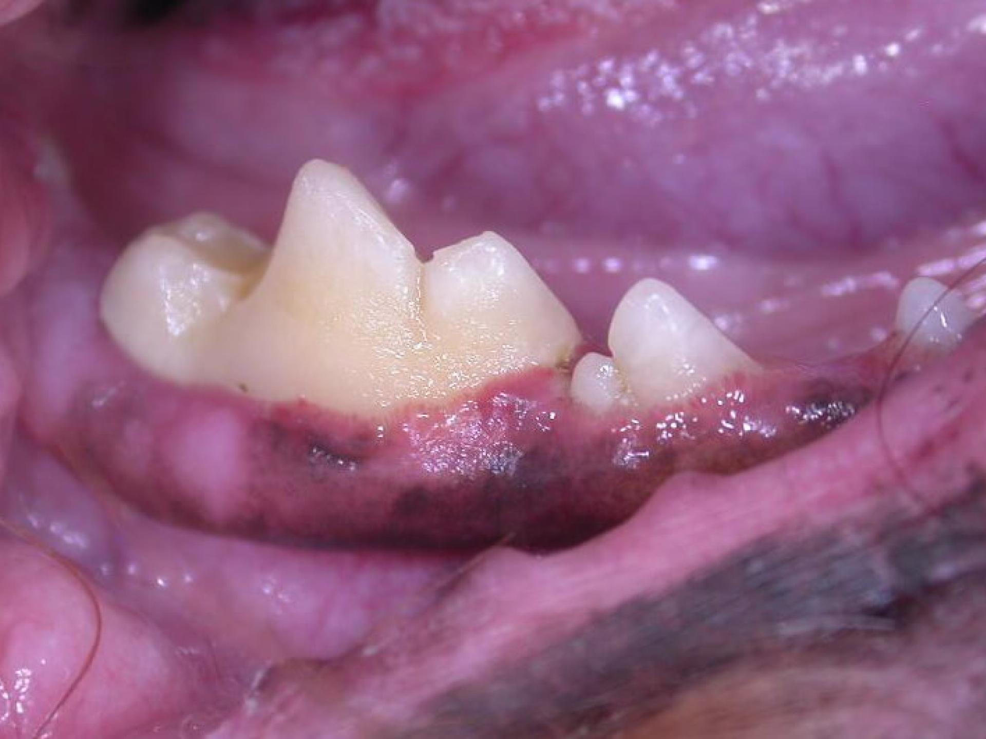 Dental Photos